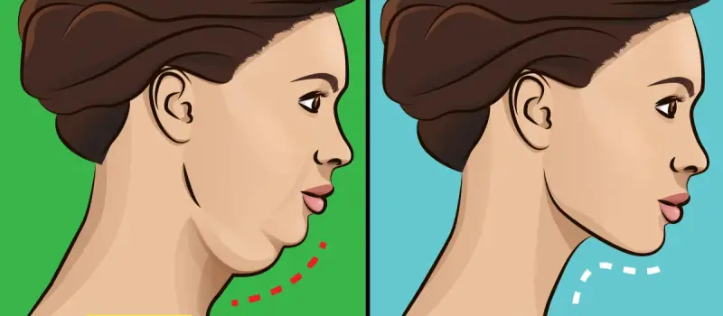 5 Exercises That Will Eliminate Your Double Chin