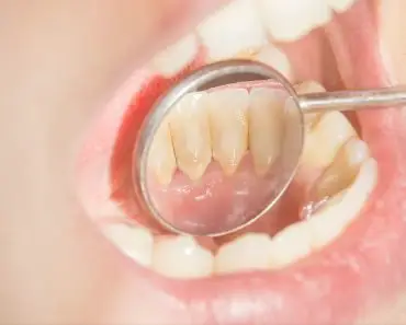 Remove plaque from your teeth just in 2 minutes!