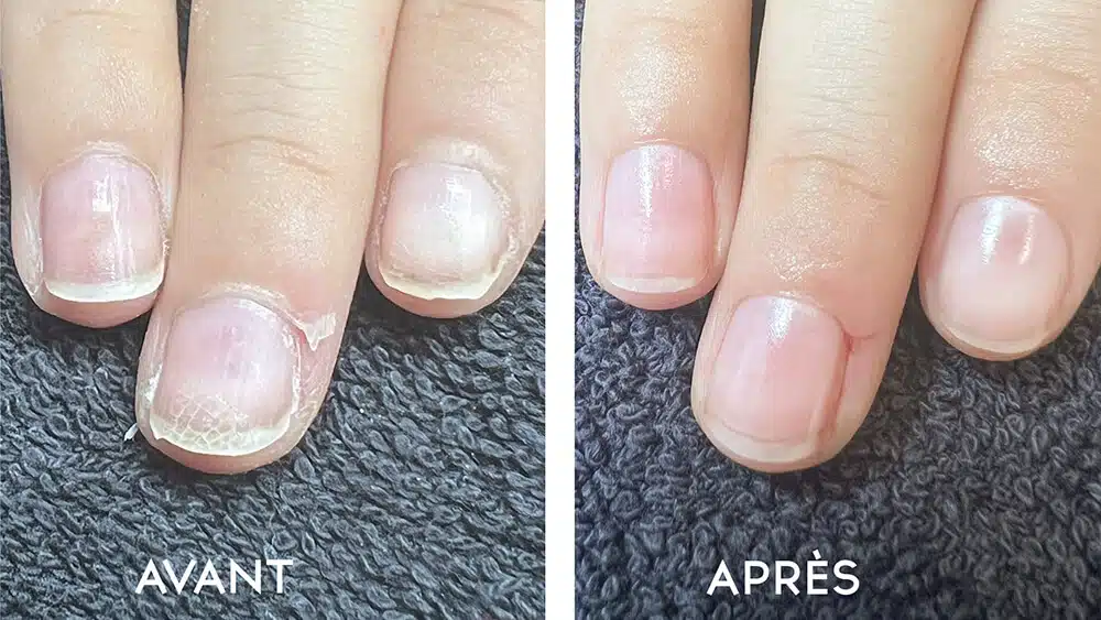 before and after nail care