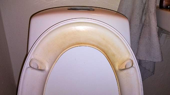 Toilet seat with yellow stains