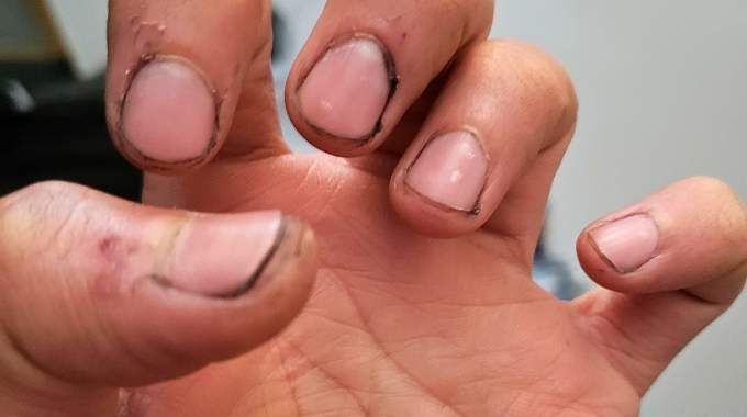 Dirty nails stained with dirt