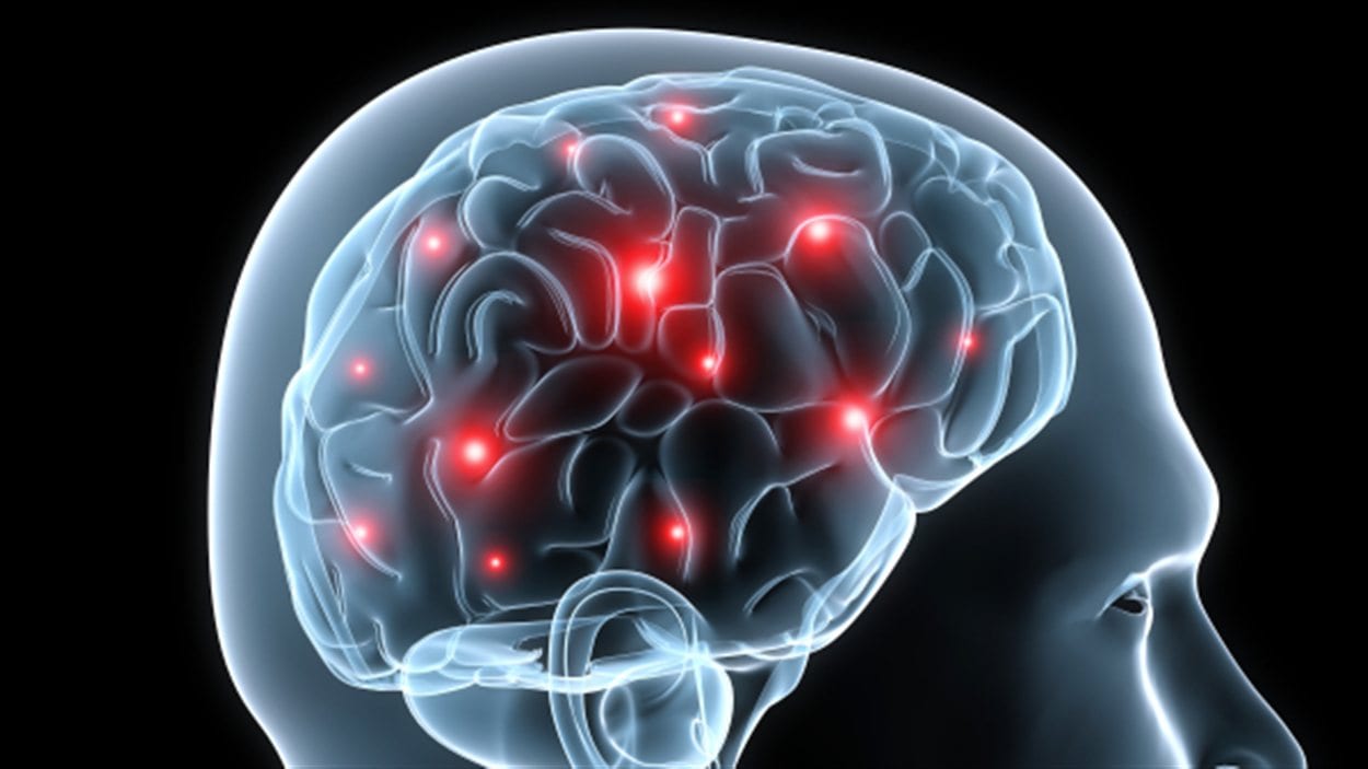 Symbolic image of brain activity