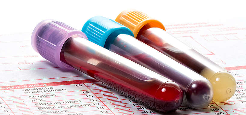 A blood collection tube for a genetic test