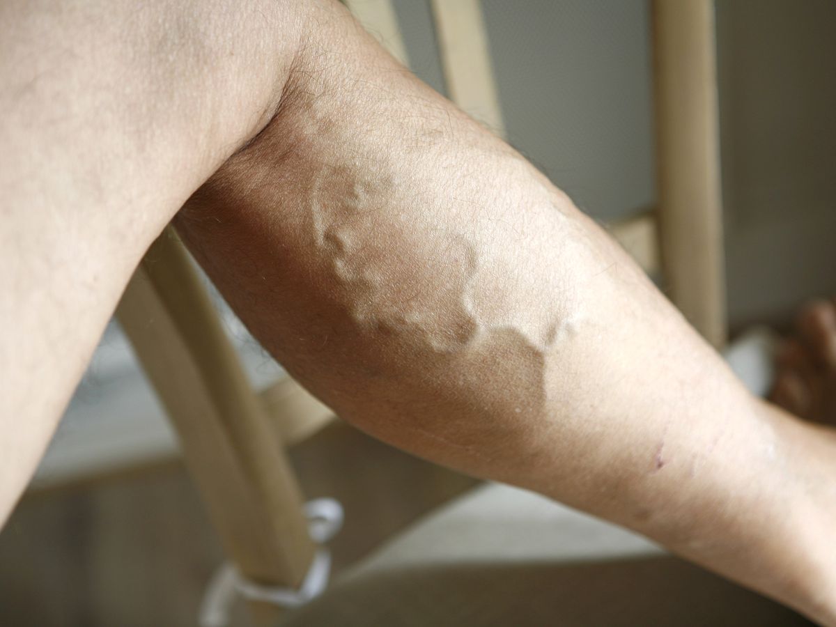 Person Elevating Legs