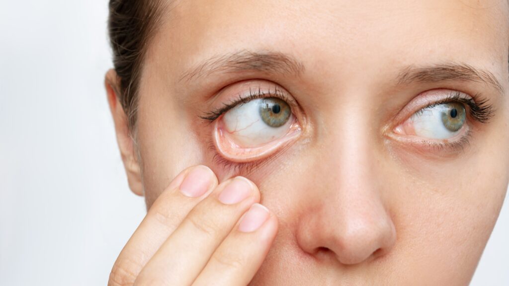 Is your body colonized? 10 signs not to ignore to regain control